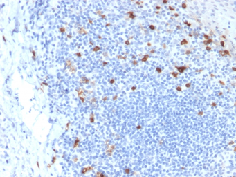 Anti-Integrin alpha E antibody [ITGAE/2063] used in IHC (Paraffin sections) (IHC-P). GTX18035