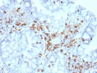 Anti-Integrin alpha E antibody [ITGAE/2063] used in IHC (Paraffin sections) (IHC-P). GTX18035