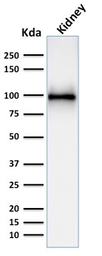 Anti-CD10 antibody [MME/1892] used in Western Blot (WB). GTX18043
