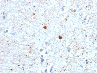 Anti-Ubiquitin antibody [UBB/1748] used in IHC (Paraffin sections) (IHC-P). GTX18045