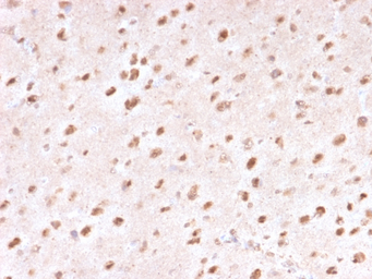 Anti-Ubiquitin antibody [UBB/1748] used in IHC (Paraffin sections) (IHC-P). GTX18045