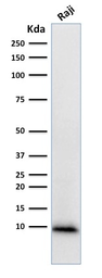 Anti-Ubiquitin antibody [UBB/1748] used in Western Blot (WB). GTX18045