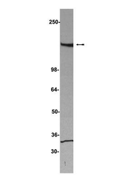 Anti-SAFB antibody [4i59] used in Western Blot (WB). GTX18086