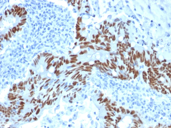 Anti-p53 antibody [PCRP-TP53-1F7] used in IHC (Paraffin sections) (IHC-P). GTX18091