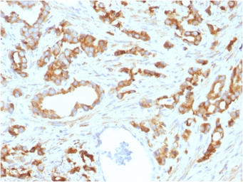 Anti-Aurora B antibody [AURKB/1593] used in IHC (Paraffin sections) (IHC-P). GTX18095