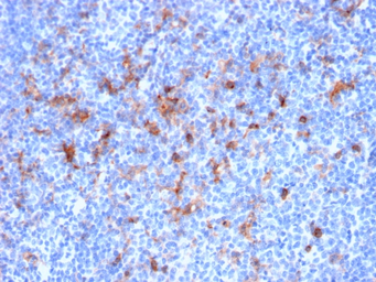 Anti-IL2 Receptor alpha antibody [IL2RA/2395] used in IHC (Paraffin sections) (IHC-P). GTX18115