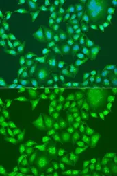 Anti-PTEN antibody used in Immunocytochemistry/ Immunofluorescence (ICC/IF). GTX18153