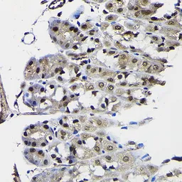 Anti-PTEN antibody used in IHC (Paraffin sections) (IHC-P). GTX18153