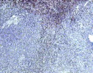 Anti-IL22 Receptor alpha 1 antibody used in Immunohistochemistry (IHC). GTX18568