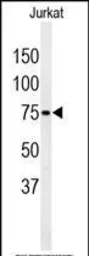 Anti-PAN3 antibody used in Western Blot (WB). GTX18622