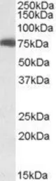 Anti-USH1C antibody used in Western Blot (WB). GTX19045
