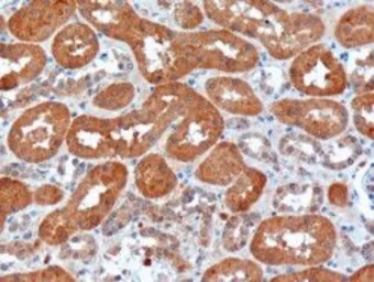 Anti-USH1C antibody used in IHC (Paraffin sections) (IHC-P). GTX19045