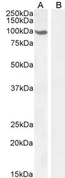 Anti-Androgen Receptor antibody, N-term used in Western Blot (WB). GTX19066