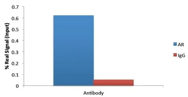Anti-Androgen Receptor antibody, N-term used in ChIP assay (ChIP assay). GTX19066