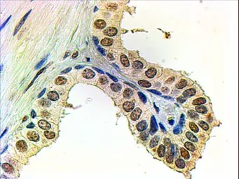 Anti-Androgen Receptor antibody, N-term used in IHC (Paraffin sections) (IHC-P). GTX19066