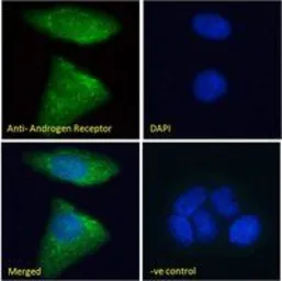 Anti-Androgen Receptor antibody, N-term used in Immunocytochemistry/ Immunofluorescence (ICC/IF). GTX19066