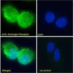 Anti-Androgen Receptor antibody, N-term used in Immunocytochemistry/ Immunofluorescence (ICC/IF). GTX19066