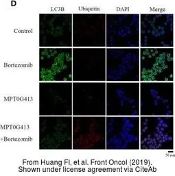Anti-Ubiquitin antibody used in Immunocytochemistry/ Immunofluorescence (ICC/IF). GTX19247