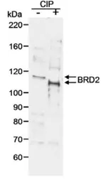 Anti-BRD2 antibody used in Western Blot (WB). GTX19276
