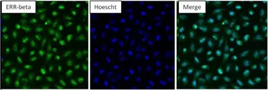 Anti-ERR beta antibody used in Immunocytochemistry/ Immunofluorescence (ICC/IF). GTX19331