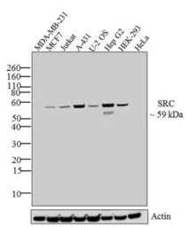 Anti-Src antibody [184Q20] used in Western Blot (WB). GTX19336