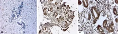 Anti-N-Cadherin antibody [8C11] used in IHC (Paraffin sections) (IHC-P). GTX19348