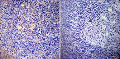 Anti-CRMP5 antibody [CR-3] used in IHC (Paraffin sections) (IHC-P). GTX19352