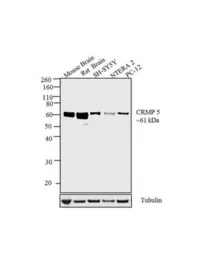 Anti-CRMP5 antibody [CR-3] used in Western Blot (WB). GTX19352