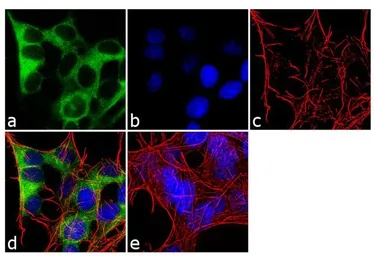 Anti-CRMP5 antibody [CR-3] used in Immunocytochemistry/ Immunofluorescence (ICC/IF). GTX19352