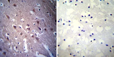 Anti-CRMP5 antibody [CR-1] used in IHC (Paraffin sections) (IHC-P). GTX19378