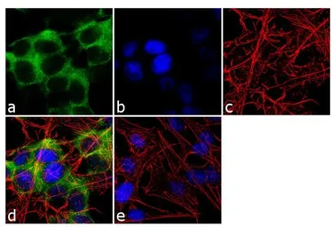Anti-CRMP5 antibody [CR-1] used in Immunocytochemistry/ Immunofluorescence (ICC/IF). GTX19378
