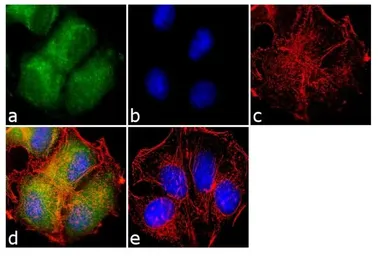 Anti-Her3 / ErbB3 antibody [RTJ2] used in Immunocytochemistry/ Immunofluorescence (ICC/IF). GTX19389