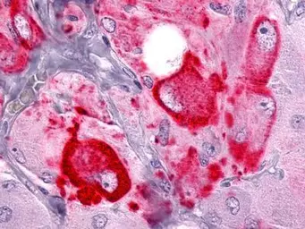 Anti-FABP3 antibody [9F3] used in Immunohistochemistry (IHC). GTX19725