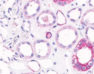 Anti-Collagen V antibody [MC5-HA] used in Immunohistochemistry (IHC). GTX19812