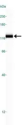 Anti-SR-BI antibody used in Western Blot (WB). GTX20003