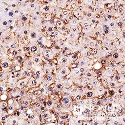 Anti-SR-BI antibody used in IHC (Paraffin sections) (IHC-P). GTX20003