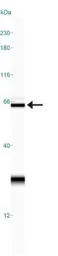 Anti-Calreticulin antibody used in Western Blot (WB). GTX20004