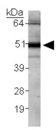 Anti-Calreticulin antibody used in Western Blot (WB). GTX20004