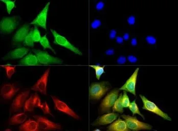 Anti-Calreticulin antibody used in Immunocytochemistry/ Immunofluorescence (ICC/IF). GTX20004