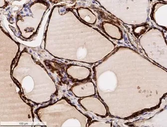 Anti-Calreticulin antibody used in IHC (Paraffin sections) (IHC-P). GTX20004