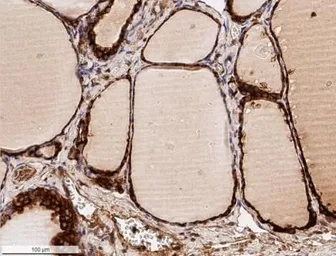 Anti-Calreticulin antibody used in IHC (Paraffin sections) (IHC-P). GTX20004