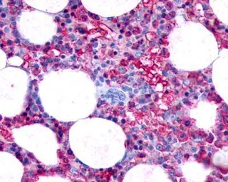 Anti-CD44 antibody [P2A1] used in Immunohistochemistry (IHC). GTX20051