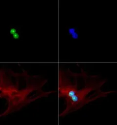 Anti-p19ARF antibody used in Immunocytochemistry/ Immunofluorescence (ICC/IF). GTX20080