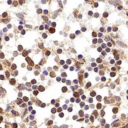 Anti-p19ARF antibody used in IHC (Paraffin sections) (IHC-P). GTX20080