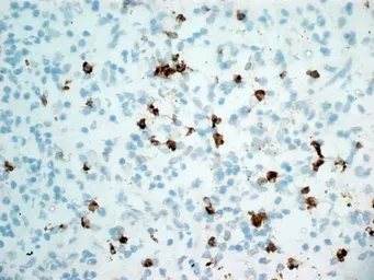 Anti-CD11b antibody [ICRF44] used in IHC (Frozen sections) (IHC-Fr). GTX20183