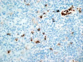 Anti-CD11b antibody [ICRF44] used in IHC (Frozen sections) (IHC-Fr). GTX20183