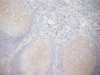 Anti-CD11b antibody [ICRF44] used in IHC (Frozen sections) (IHC-Fr). GTX20183