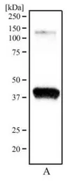 Anti-Ogg1 antibody used in Western Blot (WB). GTX20204