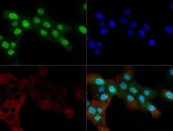 Anti-Ogg1 antibody used in Immunocytochemistry/ Immunofluorescence (ICC/IF). GTX20204