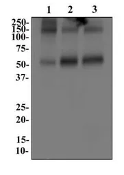Anti-EAAT1 antibody used in Western Blot (WB). GTX20262